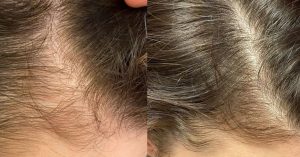 ReHair, iBrows, părul